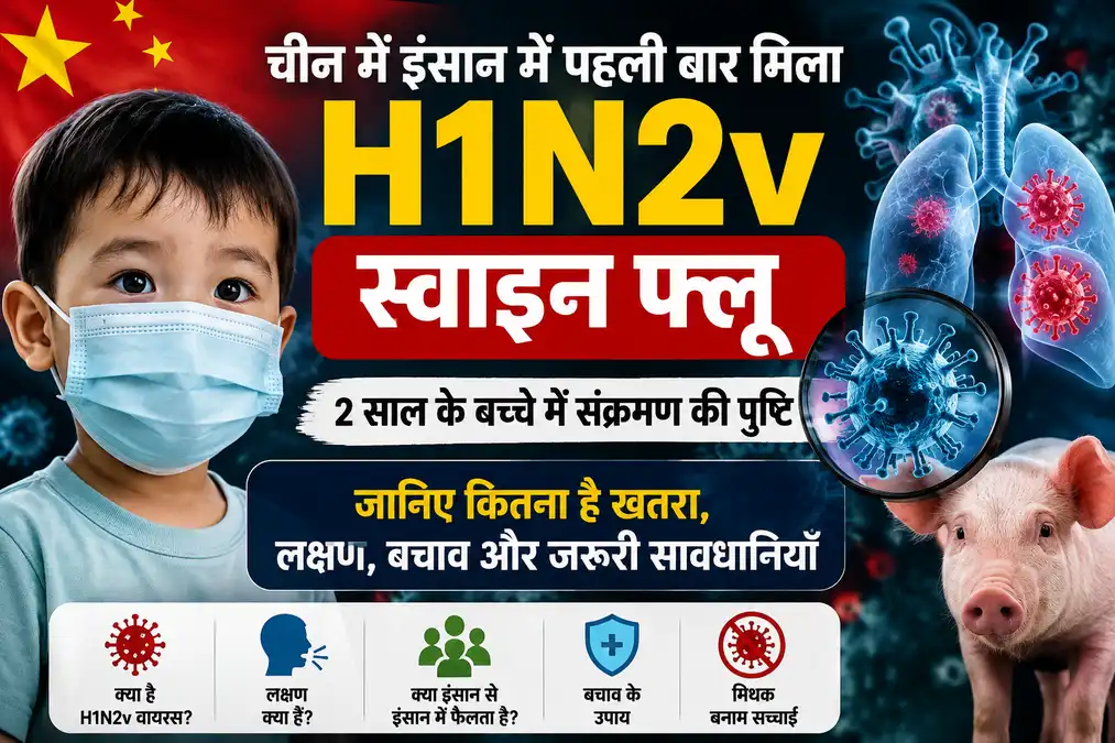 चीन में H1N2v Swine Flu संक्रमण की जानकारी